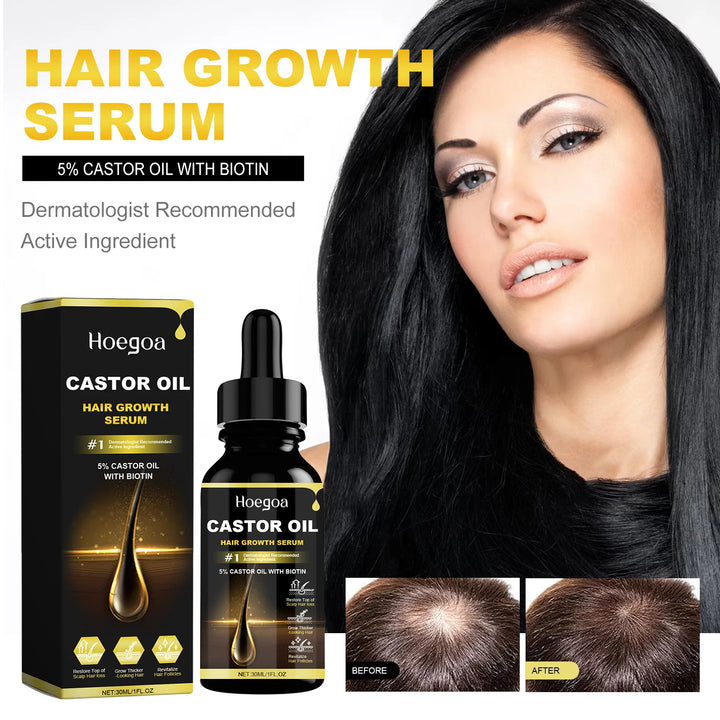 Hoegoa Castor Oil Hair Growth & Thickening Oil – 30ml