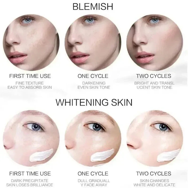 Niacinamide Whitening Freckle Cream – Dark Spot & Anti-Aging