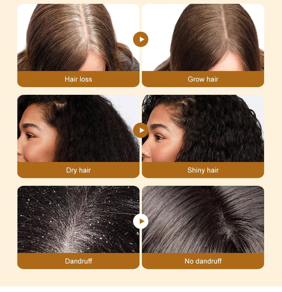 Lewedo Naturals Batana Oil – Fast Hair Growth & Nourishing