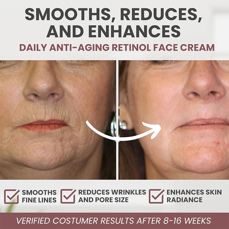 Instant Retinol Cream – Anti-Aging Wrinkle Remover & Firming