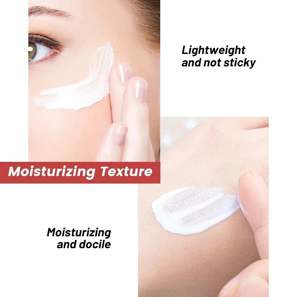 Niacinamide Whitening Freckle Cream – Dark Spot & Anti-Aging