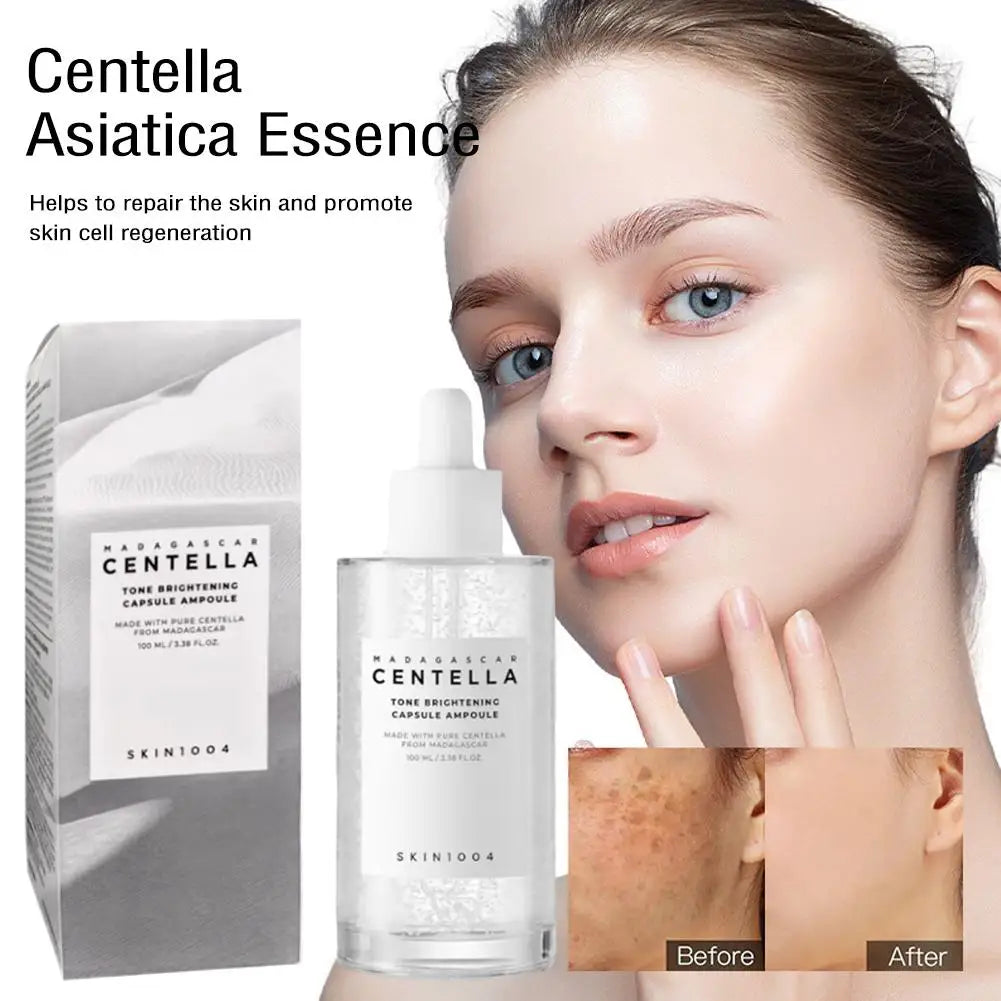 Skin1004 Madagascar Centella Asiatica Ampoule