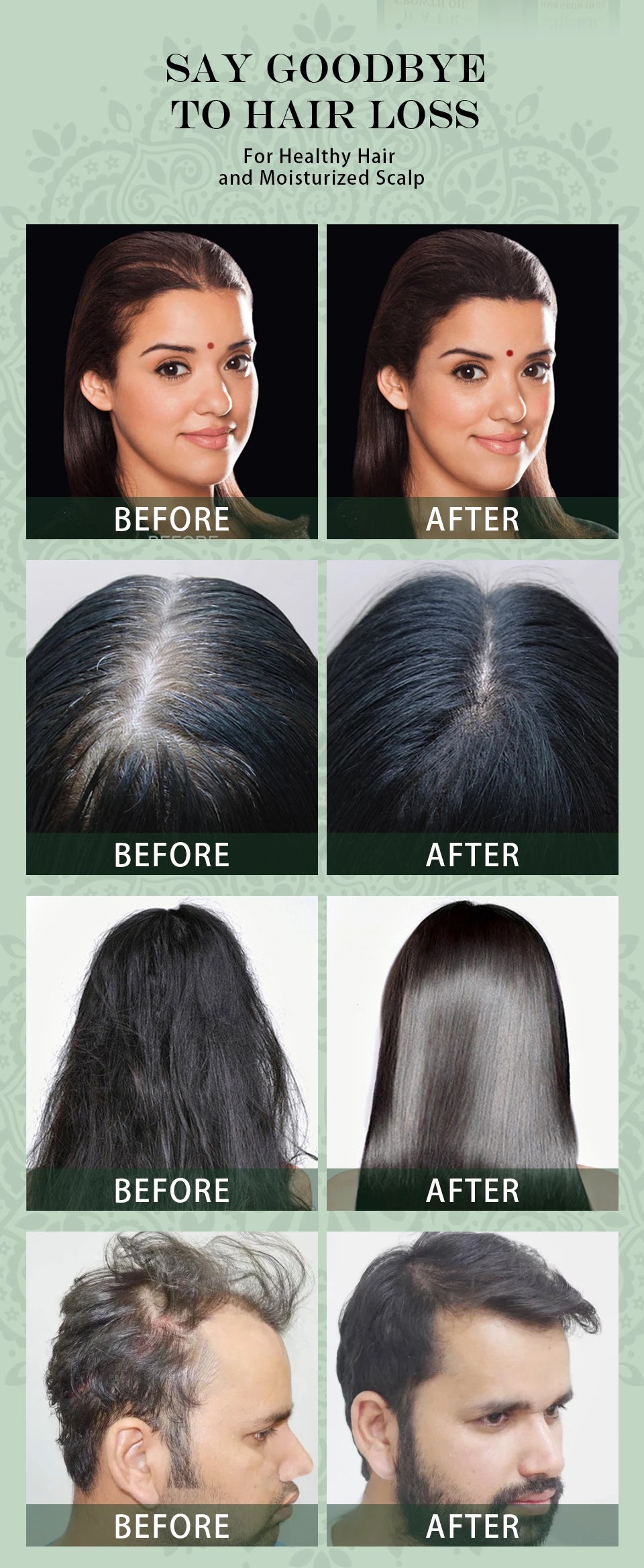 Ayurvedic Hair Growth Oil – Organic Hair Regrowth Serum