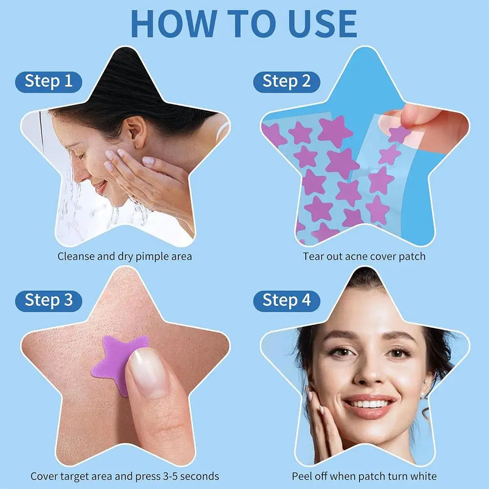 Colorful Star Pimple Patch – Acne Spot Stickers