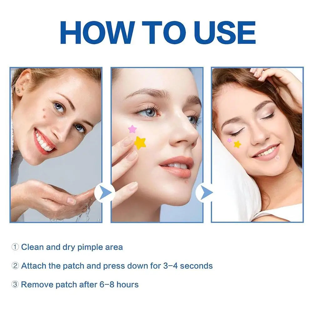 Colorful Star Pimple Patch – Acne Spot Stickers