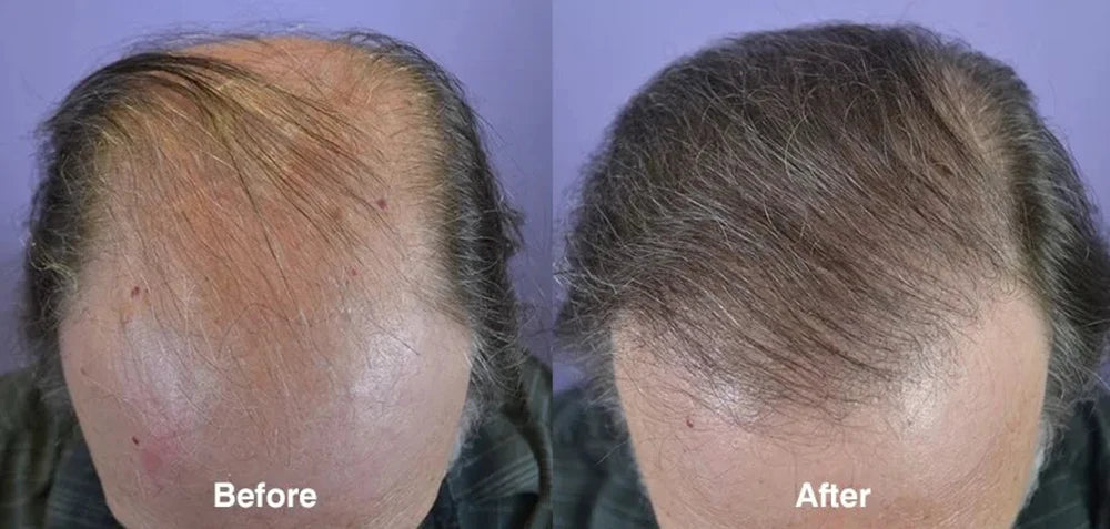 Ginger Hair Care Oil