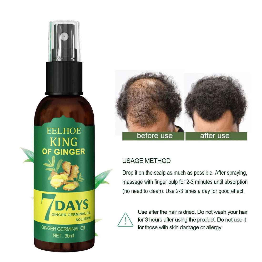 Ginger Hair Growth Spray – Nourishing Hair Essence