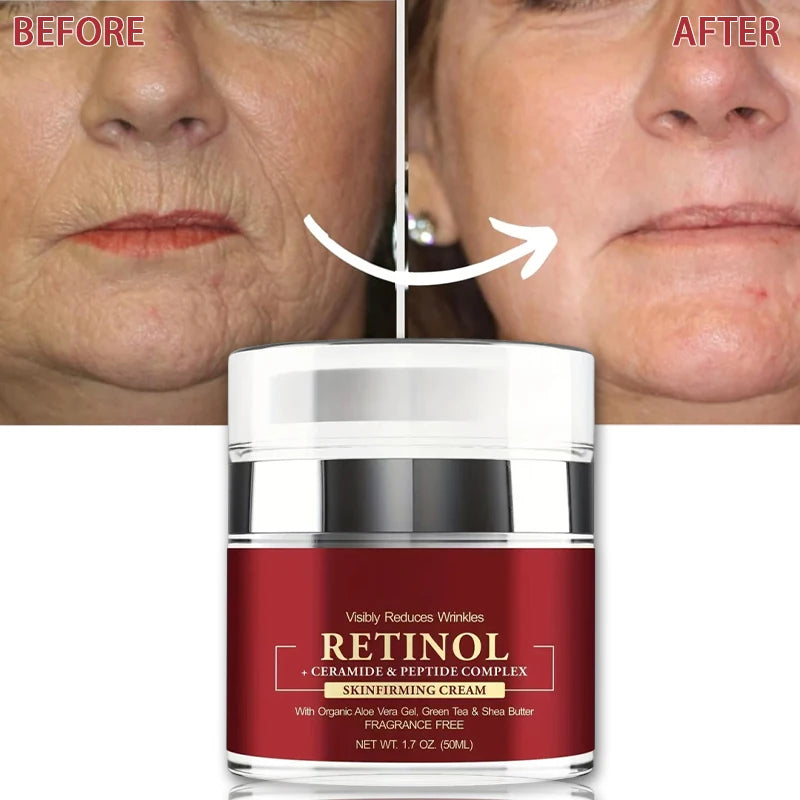 Instant Retinol Cream – Anti-Aging Wrinkle Remover & Firming