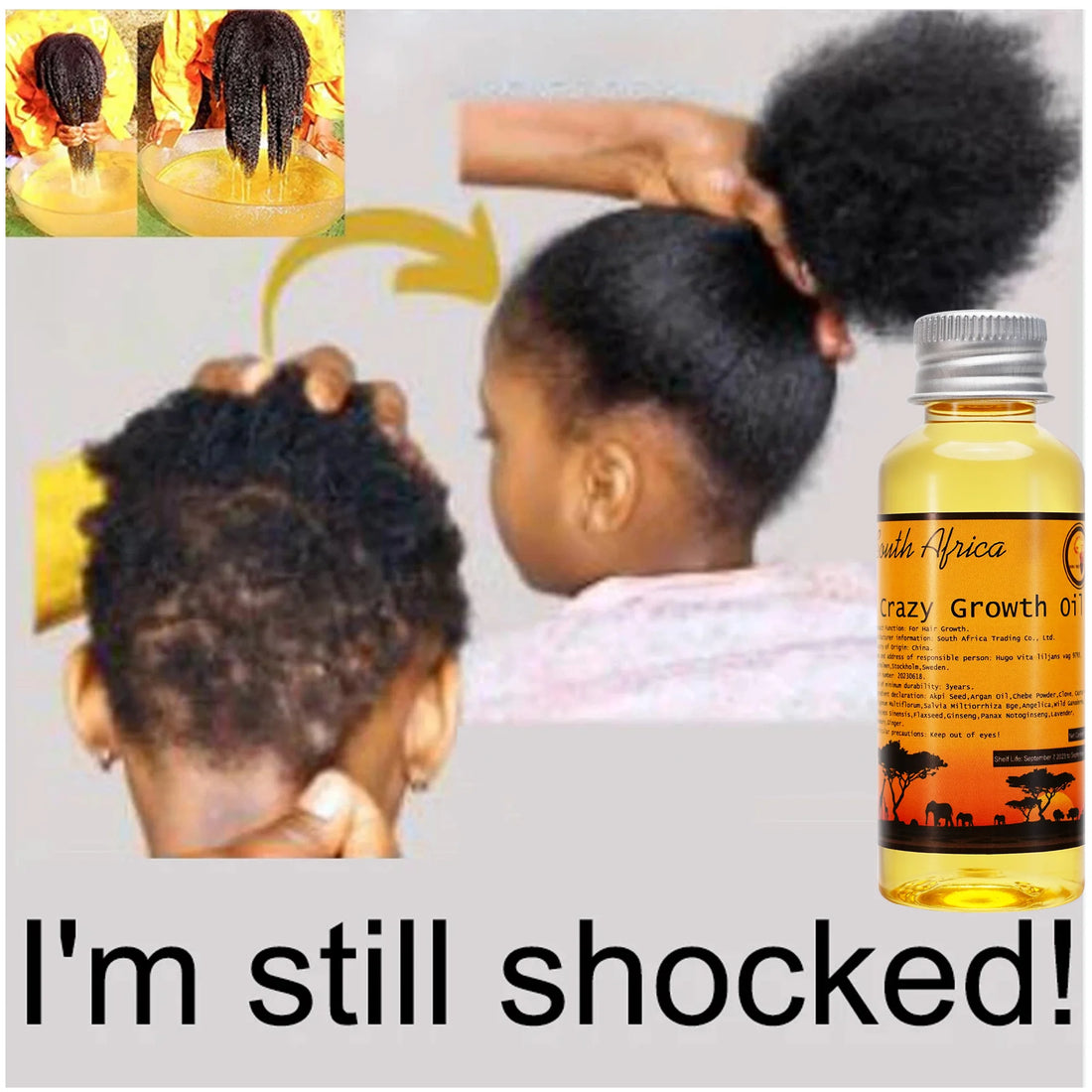 African Layden Oil – Hair Growth & Strengthening