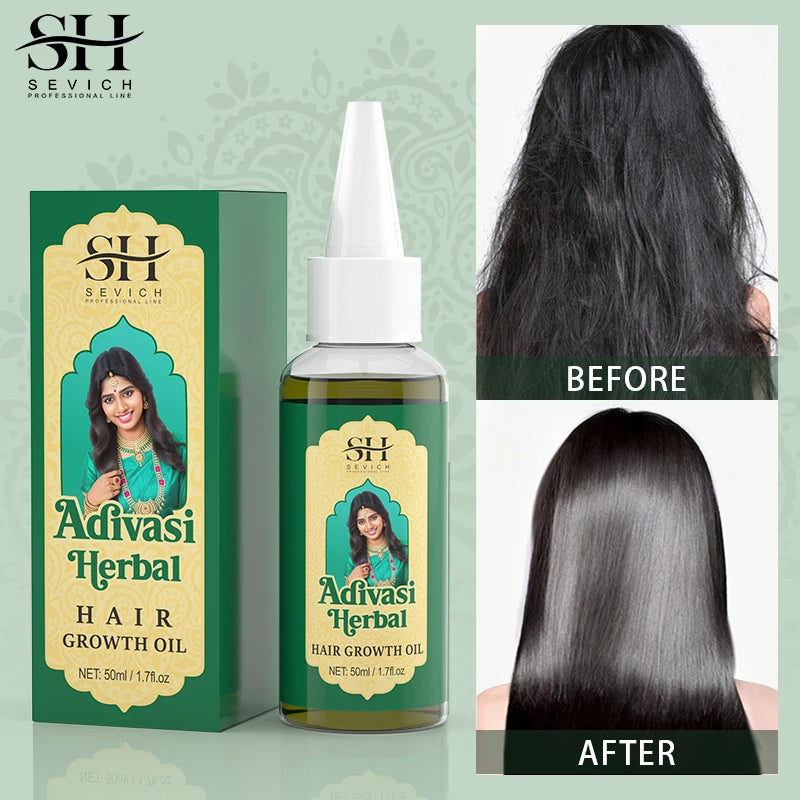 Ayurvedic Hair Growth Oil – Organic Hair Regrowth Serum