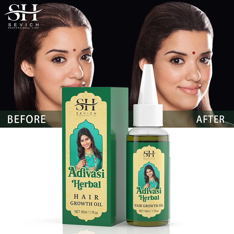 Ayurvedic Hair Growth Oil – Organic Hair Regrowth Serum