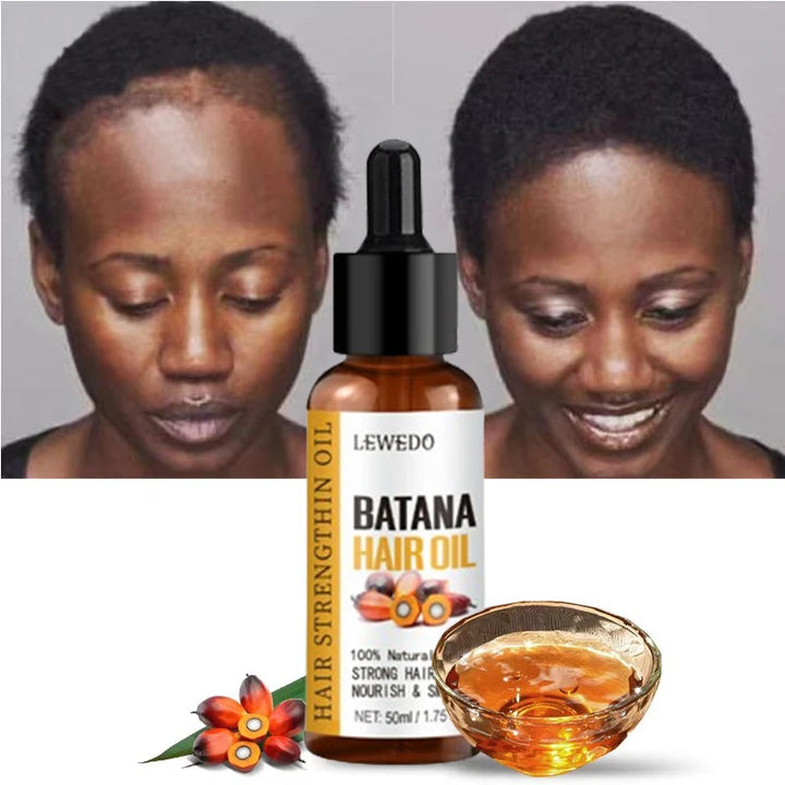 Lewedo Naturals Batana Oil – Fast Hair Growth & Nourishing