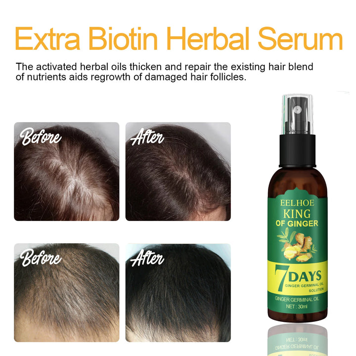 Ginger Hair Growth Spray – Nourishing Hair Essence