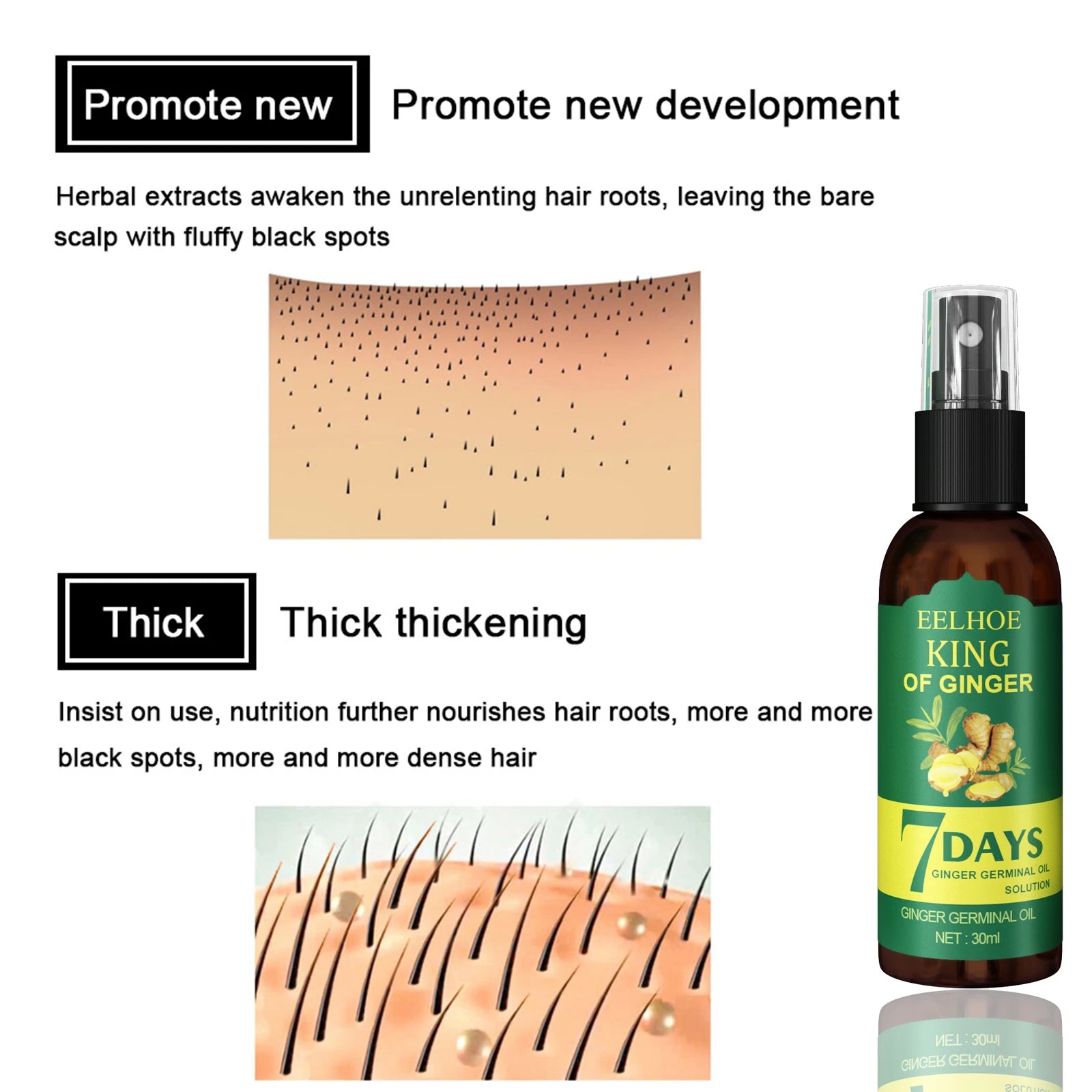 Ginger Hair Growth Spray – Nourishing Hair Essence