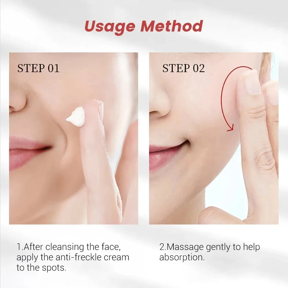 Niacinamide Whitening Freckle Cream – Dark Spot & Anti-Aging